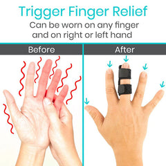 Vive Universal Finger Splint